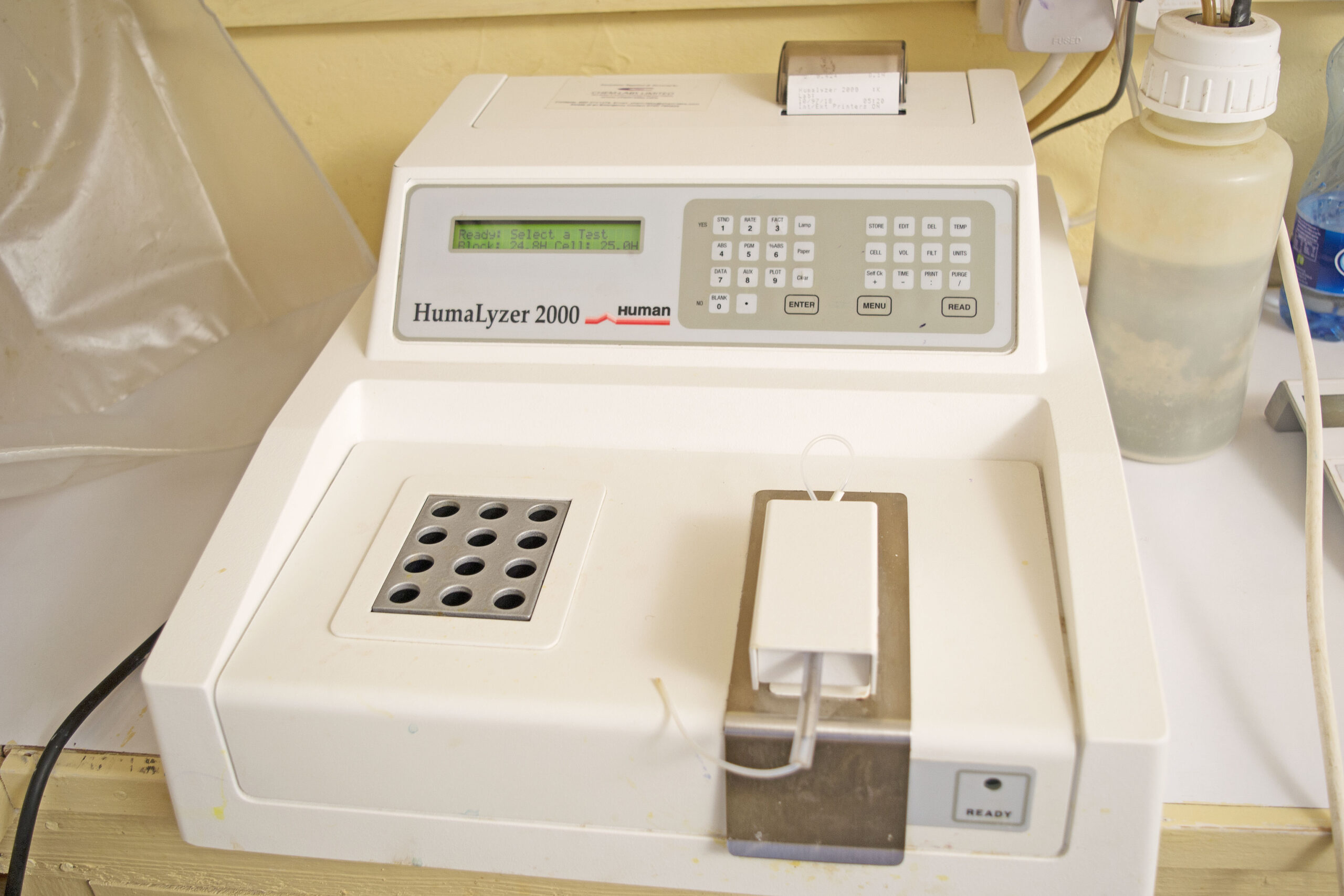 https://wananchihospital.org/wp-content/uploads/2022/07/Lab-Equipment-1-scaled.jpg
